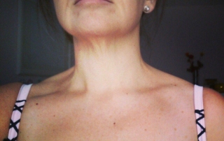 comedores-compulsivos-alimentacion-emocional-trastorno-atracon-ansiedad-por-comer